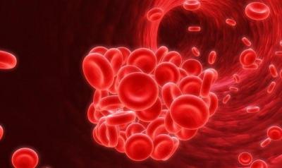 干细胞基因疗法有望用于治疗镰刀型贫血